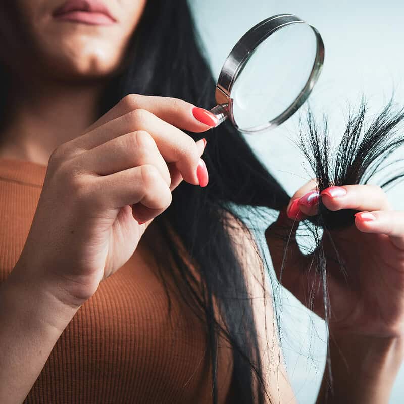 Testosterone Hair Loss